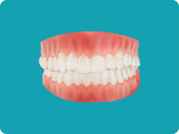 Braces Alternatives