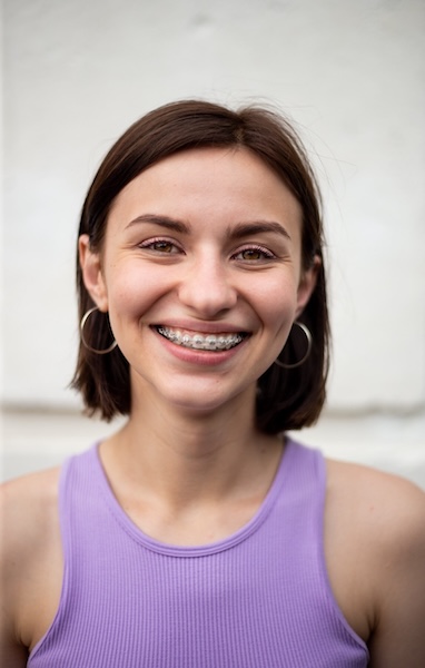Orthodontics for Adults